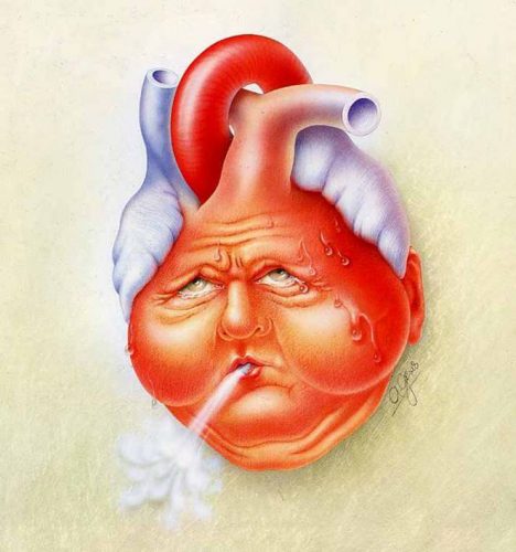 Is winter “heart failure season”?