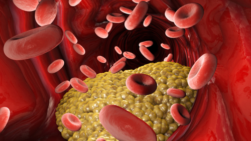 Is your HDL (good cholesterol) an indicator of heart disease risk?