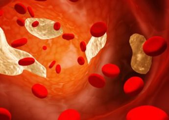 High blood cholesterol increases risk of Alzheimer's and heart disease: Study